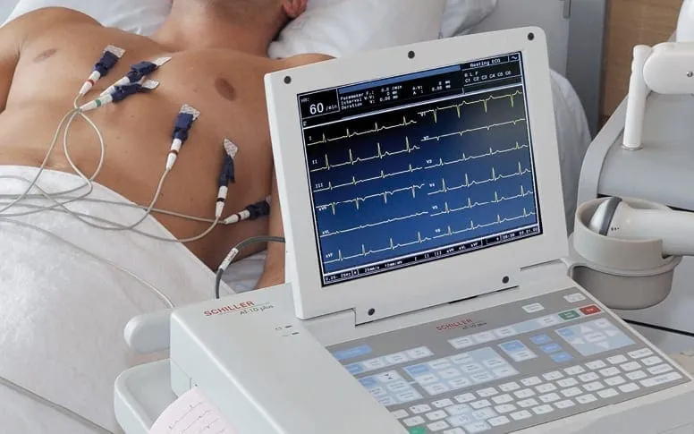ECG réalisé pour une douleur thoracique chez un cardiologue à Marrakech